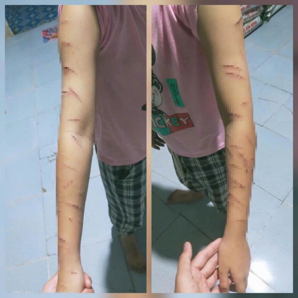 Vụ học sinh lớp 5 ở Cà Mau nghi bị bạo hành: Công an báo cáo vụ việc ban đầu như thế nào?