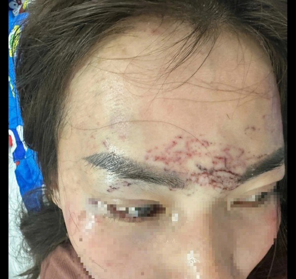 Đánh ghen, xăm lên mặt 'tình địch': 2 phụ nữ ở Cà Mau lãnh án tù Đánh ghen, xăm lên mặt 'tình địch': 2 phụ nữ ở Cà Mau lãnh án tù