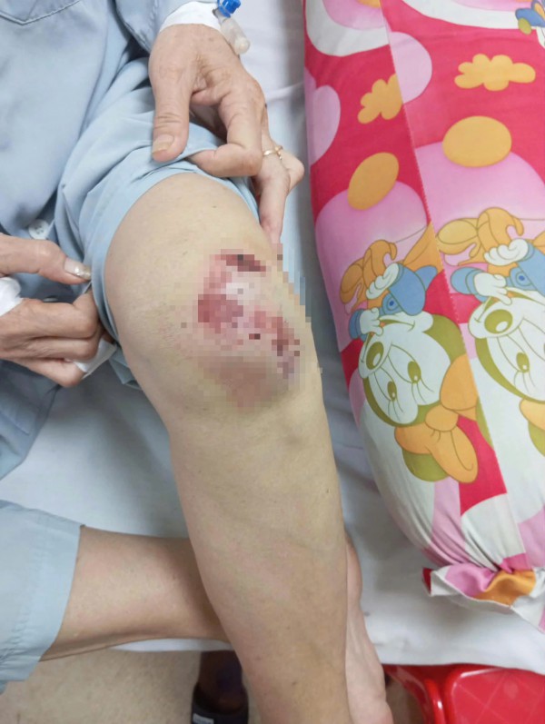 Điều tra vụ người phụ nữ bị con riêng của ba chồng dùng dao tấn công Điều tra vụ người phụ nữ bị con riêng của ba chồng dùng dao tấn công