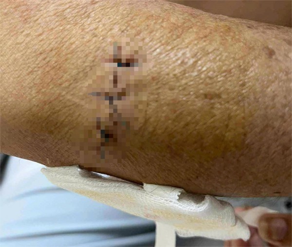 Điều tra vụ người phụ nữ bị con riêng của ba chồng dùng dao tấn công Điều tra vụ người phụ nữ bị con riêng của ba chồng dùng dao tấn công