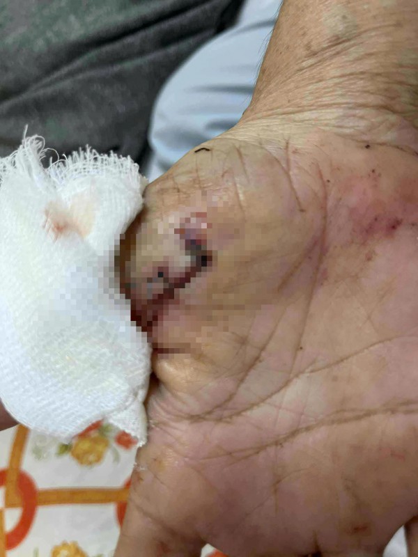 Điều tra vụ người phụ nữ bị con riêng của ba chồng dùng dao tấn công Điều tra vụ người phụ nữ bị con riêng của ba chồng dùng dao tấn công