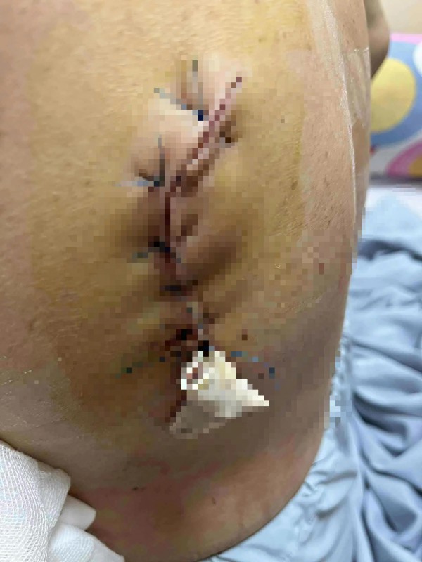 Điều tra vụ người phụ nữ bị con riêng của ba chồng dùng dao tấn công Điều tra vụ người phụ nữ bị con riêng của ba chồng dùng dao tấn công