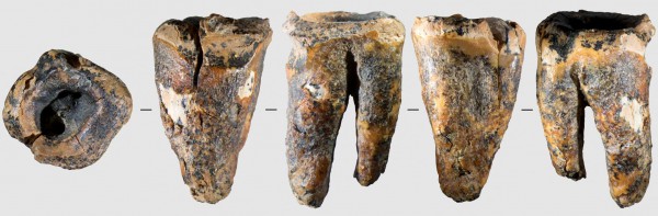 59.000 năm trước, người Neanderthal đã biết trị sâu răng?