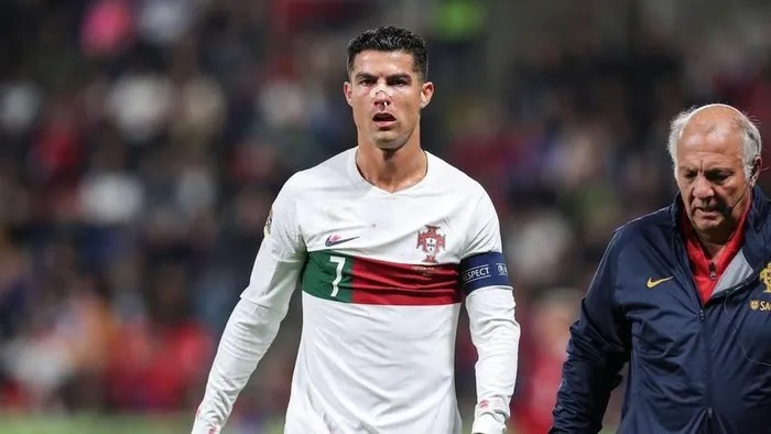 Ronaldo bị thủ môn đối phương đấm gãy mũi