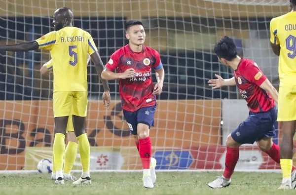 HLV Kim Sang-sik không lo bị ‘bạc tóc’, lý do này có bất ngờ không? HLV Kim Sang-sik không lo bị ‘bạc tóc’, lý do này có bất ngờ không?