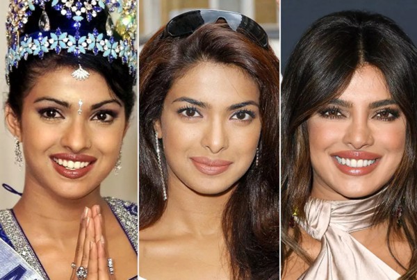 Cựu Hoa hậu Thế giới Priyanka Chopra Jonas bị 