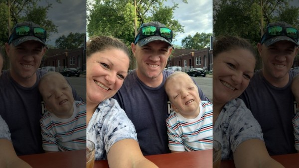 Nằm trong bụng mẹ khỏe mạnh, bé trai chào đời với hình hài kỳ lạ khiến gia đình sợ hãi và hội chứng duy nhất chỉ có mình em mắc phải Nằm trong bụng mẹ khỏe mạnh, bé trai chào đời với hình hài kỳ lạ khiến gia đình sợ hãi và hội chứng duy nhất chỉ có mình em mắc phải