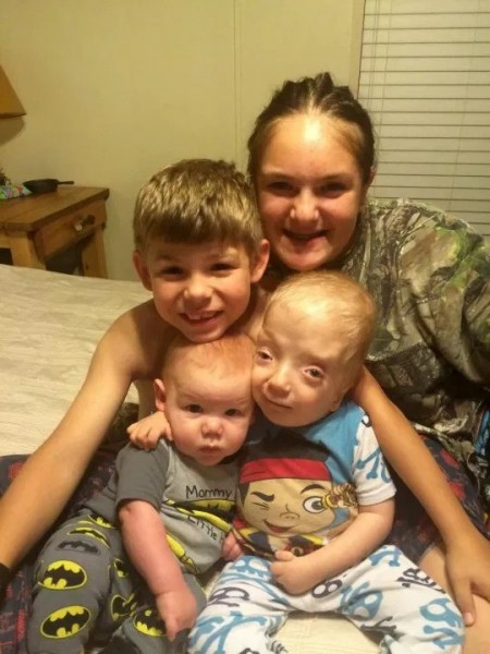 Nằm trong bụng mẹ khỏe mạnh, bé trai chào đời với hình hài kỳ lạ khiến gia đình sợ hãi và hội chứng duy nhất chỉ có mình em mắc phải Nằm trong bụng mẹ khỏe mạnh, bé trai chào đời với hình hài kỳ lạ khiến gia đình sợ hãi và hội chứng duy nhất chỉ có mình em mắc phải