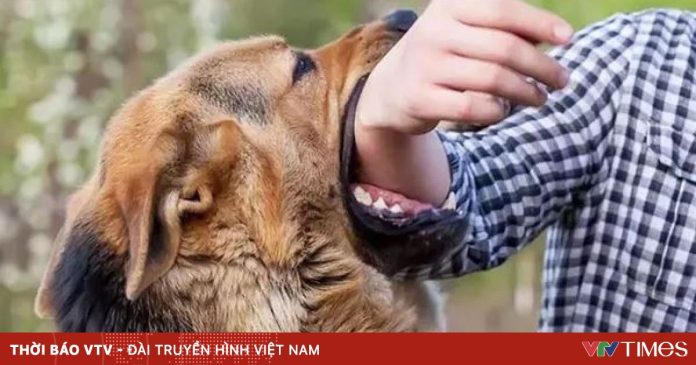 Bé trai 5 tuổi bị chó cắn rách nát mặt, phải khâu 20 mũi