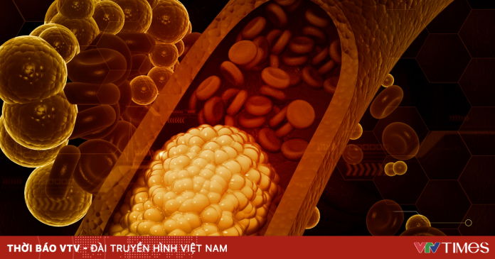 Công nghệ chỉnh sửa gen mở ra hy vọng loại bỏ vĩnh viễn tình trạng mỡ máu cao