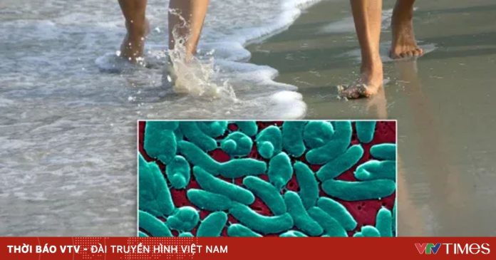 Mỹ ghi nhận một số ca tử vong do vi khuẩn ăn thịt người Mỹ ghi nhận một số ca tử vong do vi khuẩn ăn thịt người