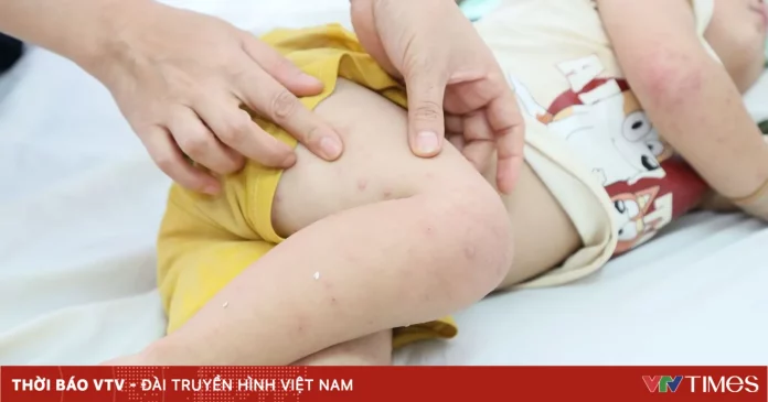 Sốt xuất huyết giảm, tay chân miệng tiếp tục tăng tại TP Hồ Chí Minh