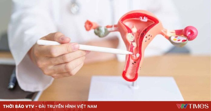 Tháng Nâng cao nhận thức về ung thư cổ tử cung: Căn bệnh có thể phòng ngừa